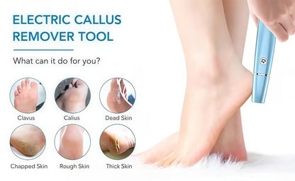 Electric Feet Callus Remover