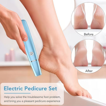 Electric Feet Callus Remover